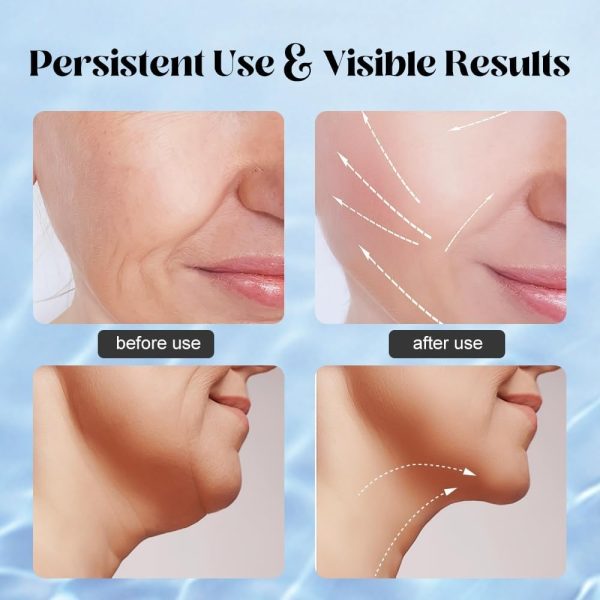 Massager For Face Lifting Facial Massagers Ems Neck Eye Massage Instrument Vibrator Microcurrents Red Light Therapy Anti Wrinkle