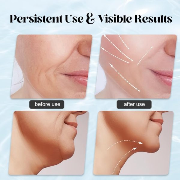 Massager For Face Lifting Facial Massagers Ems Neck Eye Massage Instrument Vibrator Microcurrents Red Light Therapy Anti Wrinkle